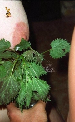 Куст крапивы между ног 10 фото